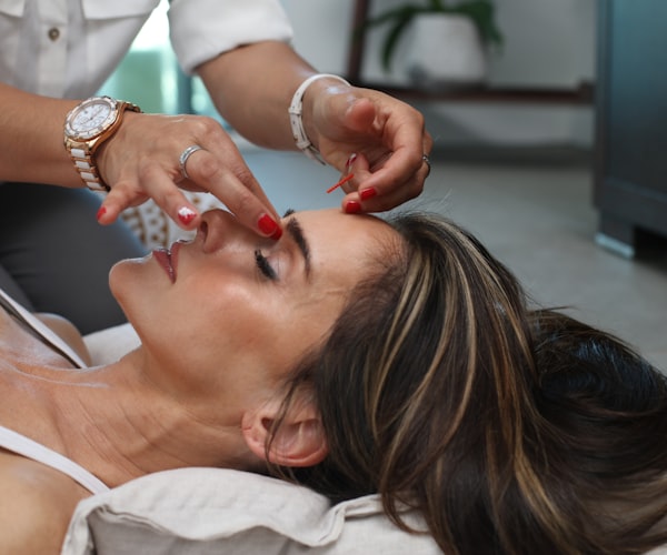 Acupuncturist placing needles on patient